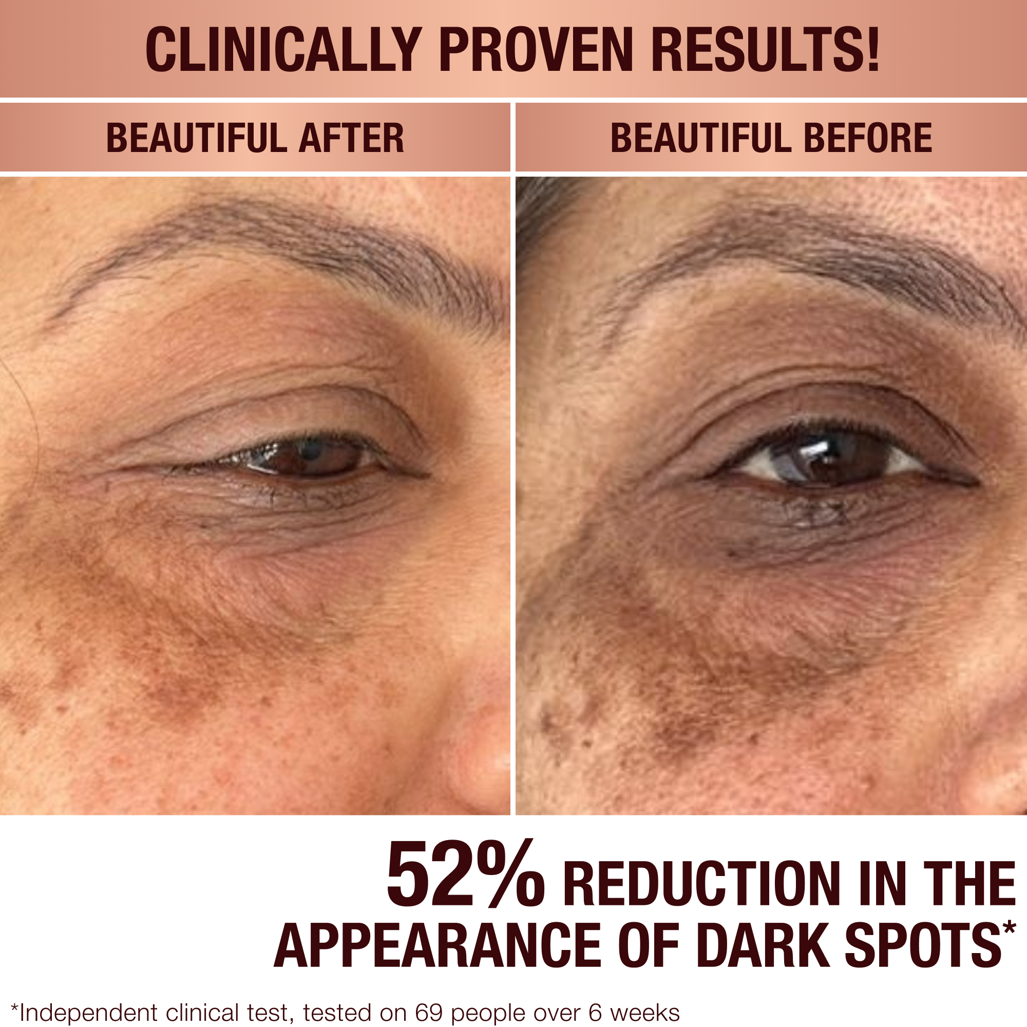 DARK SPOT CORRECTING INVISIBLE UV DUO - SKINCARE KIT - View 3