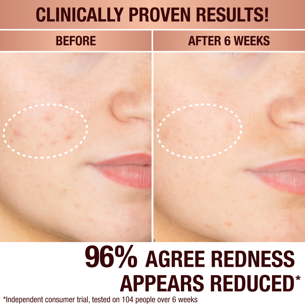 DARK SPOT CORRECTING RADIANCE RECOVERY SERUM - 10 ML - View 3