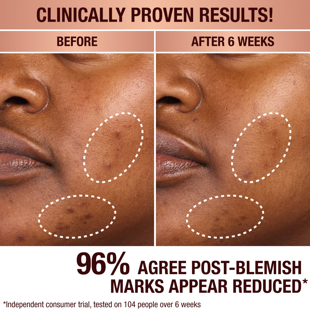 DARK SPOT CORRECTING RADIANCE RECOVERY SERUM - 10 ML - View 4